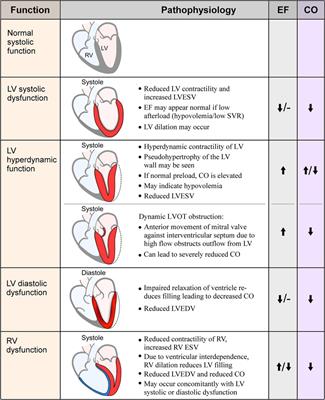 Sepsis-Induced myocardial dysfunction: heterogeneity of functional effects and clinical significance